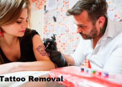 Tattoo Removal Near Me: Reclaim Your Skin with Confidence